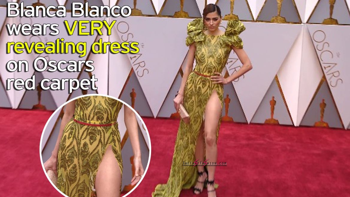 Blanca Blanco leads Oscars 2017 worst dressed.